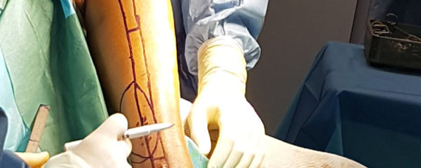 chirurgie du membre inférieur